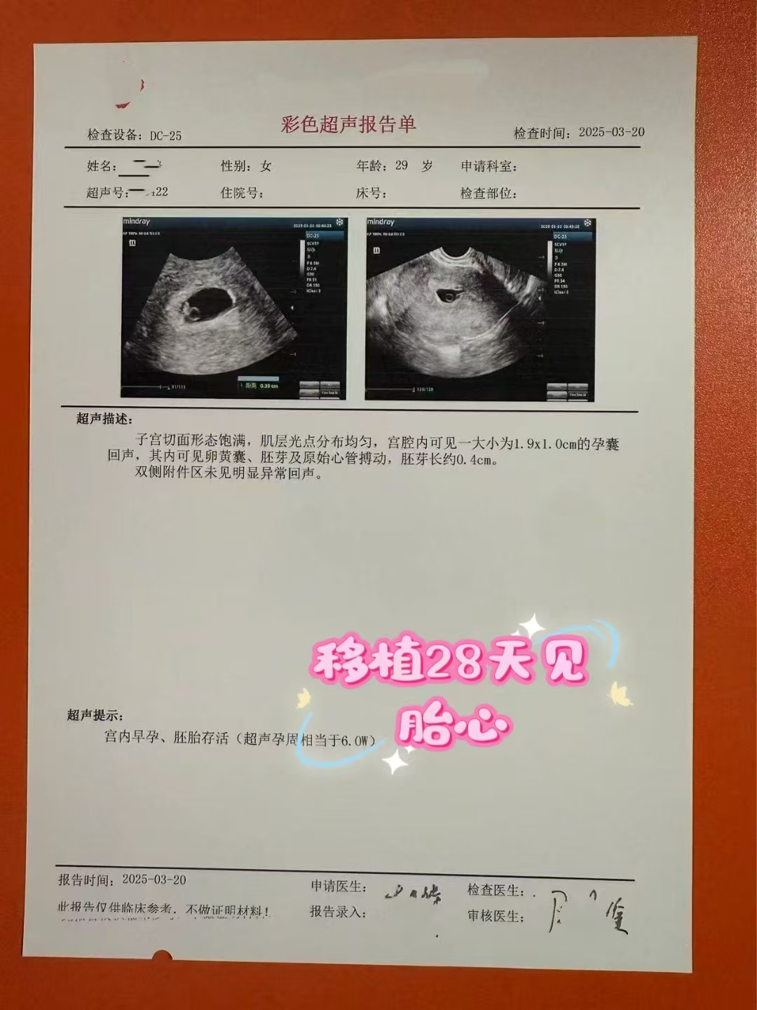 卵巢衰竭供卵自怀